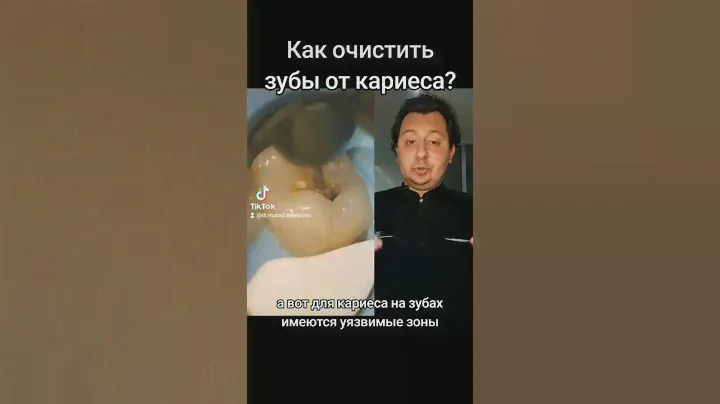 Кариес можно почистить? #кариес #кариесзубов #дантист #зубнойналет #гигиенаполостирта #чистказубов